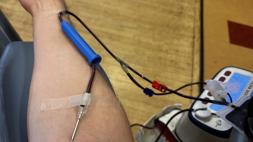 A photo of my lower arm, with a needle inserted into it, draining blood into a blood bag.